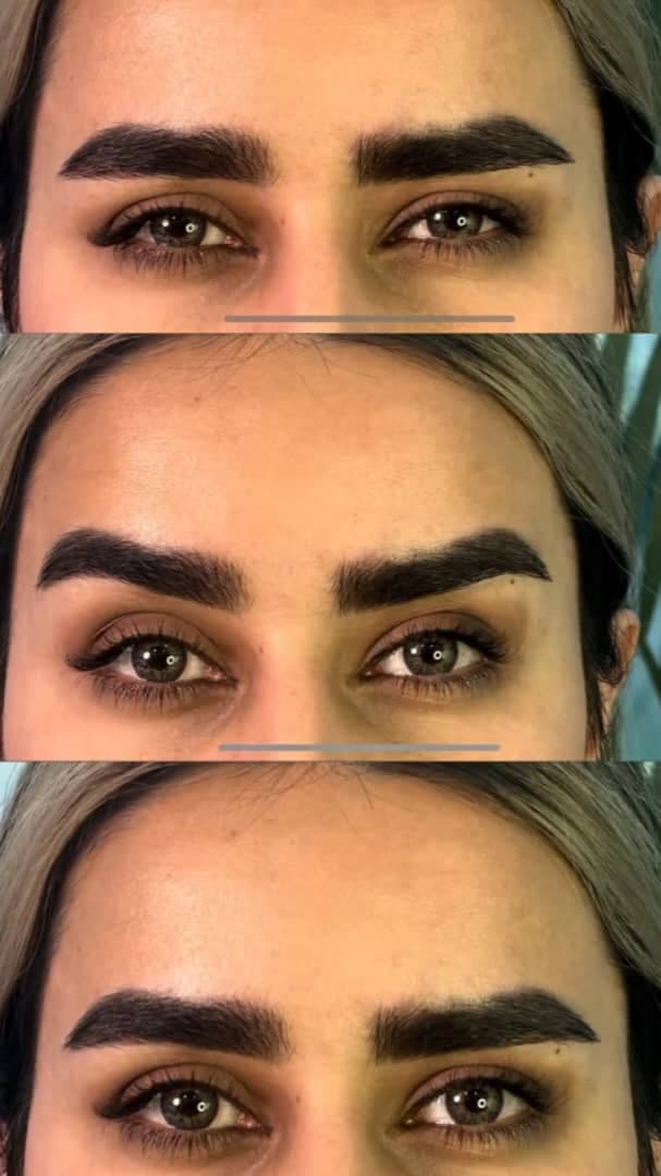 مرکز زیبایی و تزریق ژل و بوتاکس صبا میر در خرم آباد