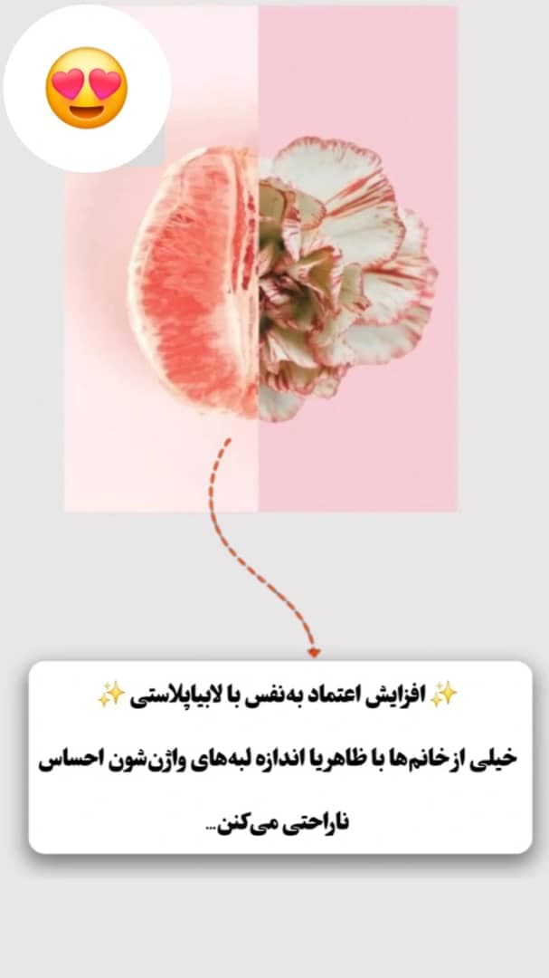 مرکز زیبایی و تزریق ژل و بوتاکس صبا میر در خرم آباد