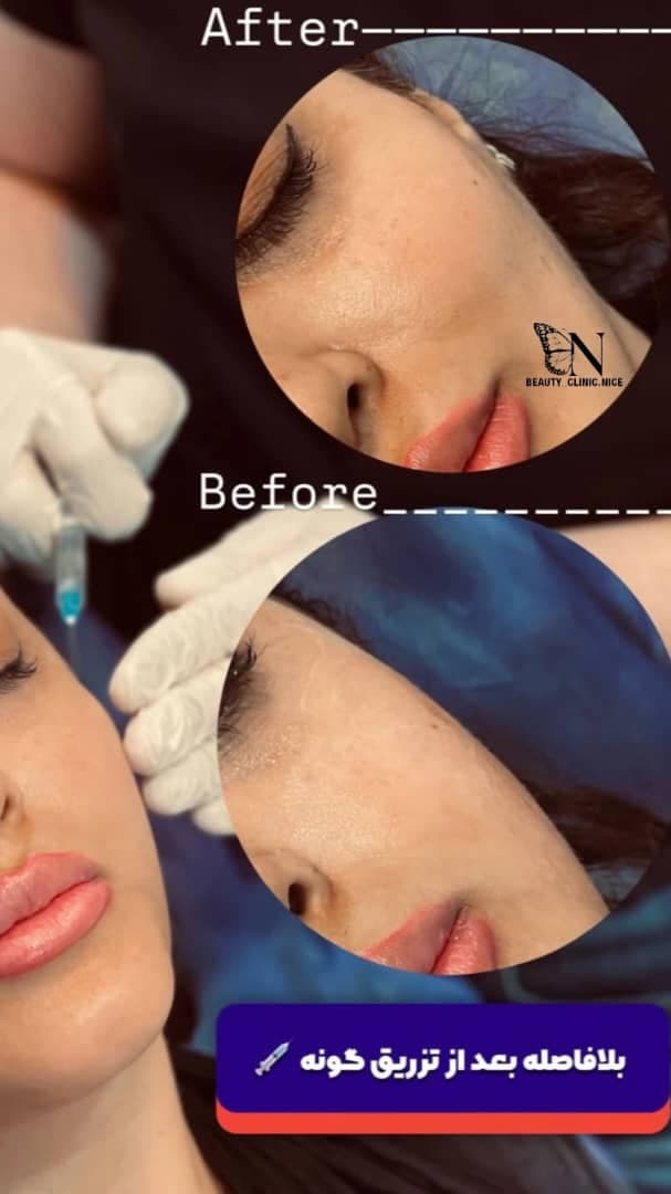 مرکز زیبایی و تزریق ژل و بوتاکس صبا میر در خرم آباد