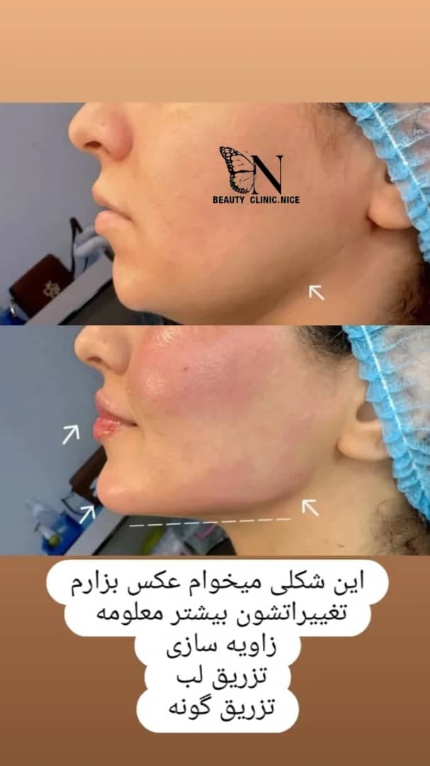 مرکز زیبایی و تزریق ژل و بوتاکس صبا میر در خرم آباد