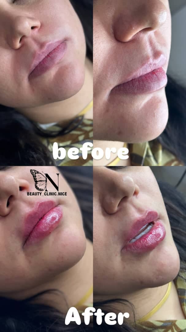 مرکز زیبایی و تزریق ژل و بوتاکس صبا میر در خرم آباد