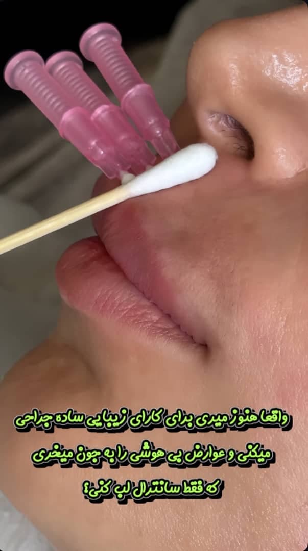 مرکز زیبایی و تزریق ژل و بوتاکس صبا میر در خرم آباد