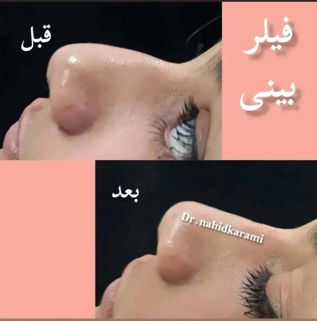 کلینیک زیبایی و لیزر لیلیا در برازجان بوشهر