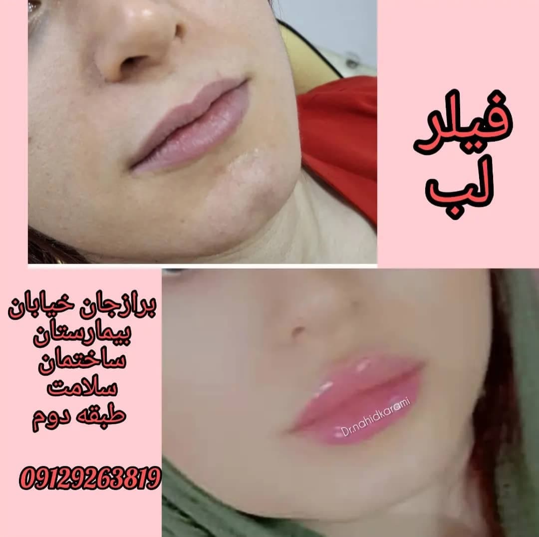 کلینیک زیبایی و لیزر لیلیا در برازجان بوشهر