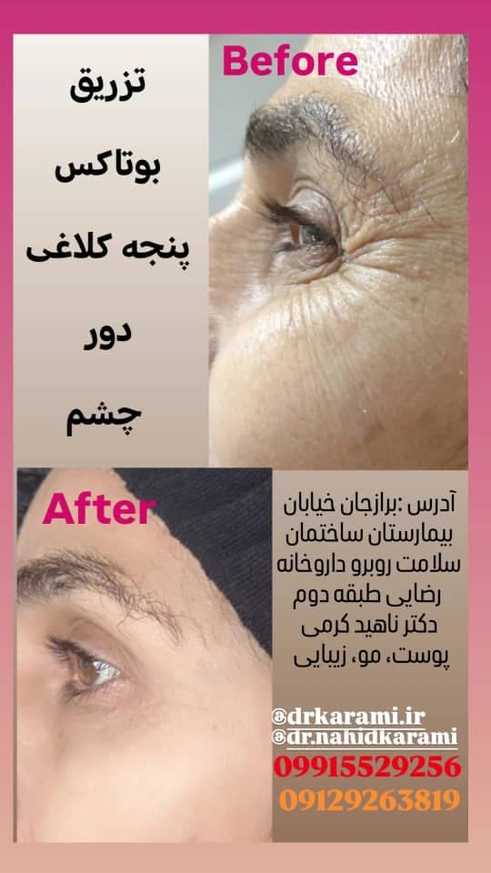 کلینیک زیبایی و لیزر لیلیا در برازجان بوشهر