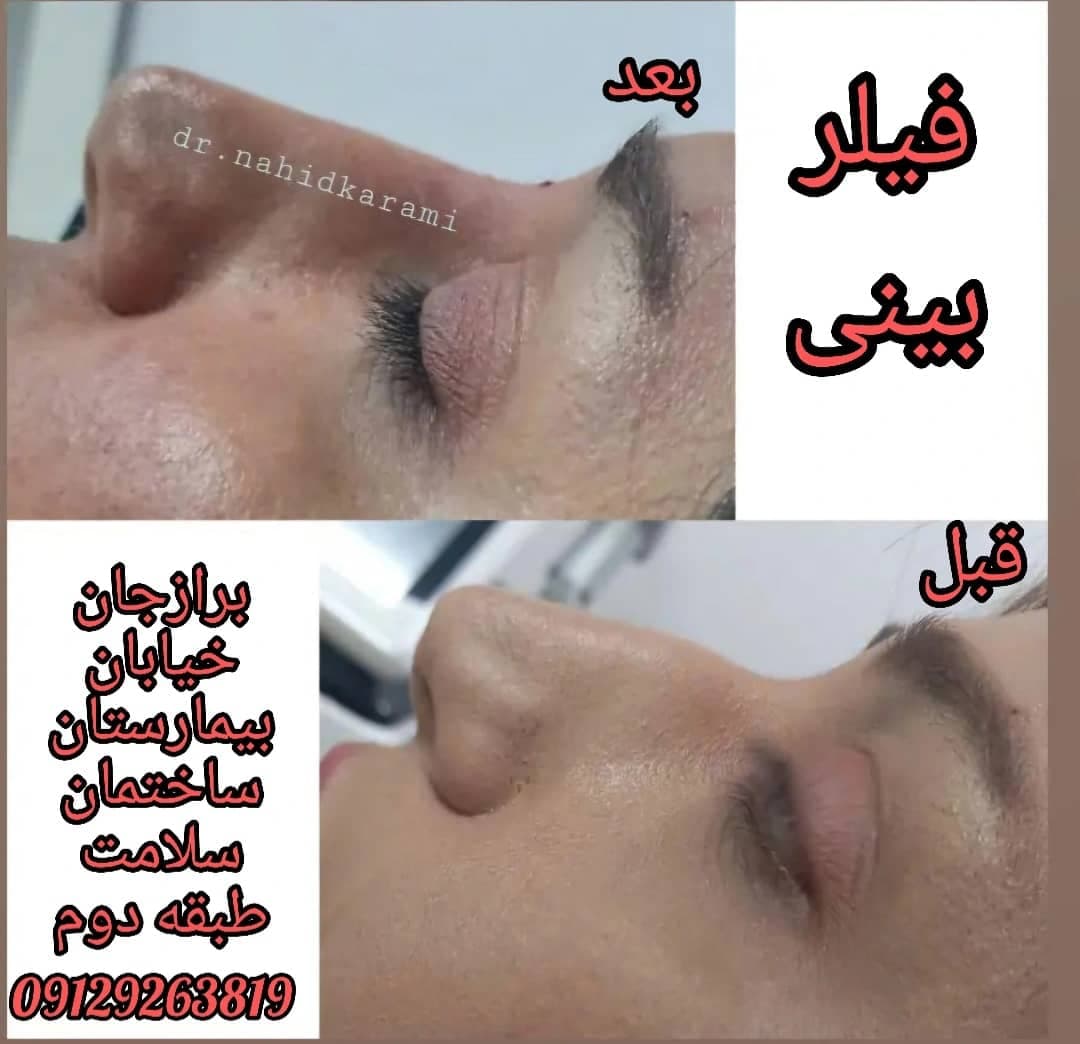 کلینیک زیبایی و لیزر لیلیا در برازجان بوشهر