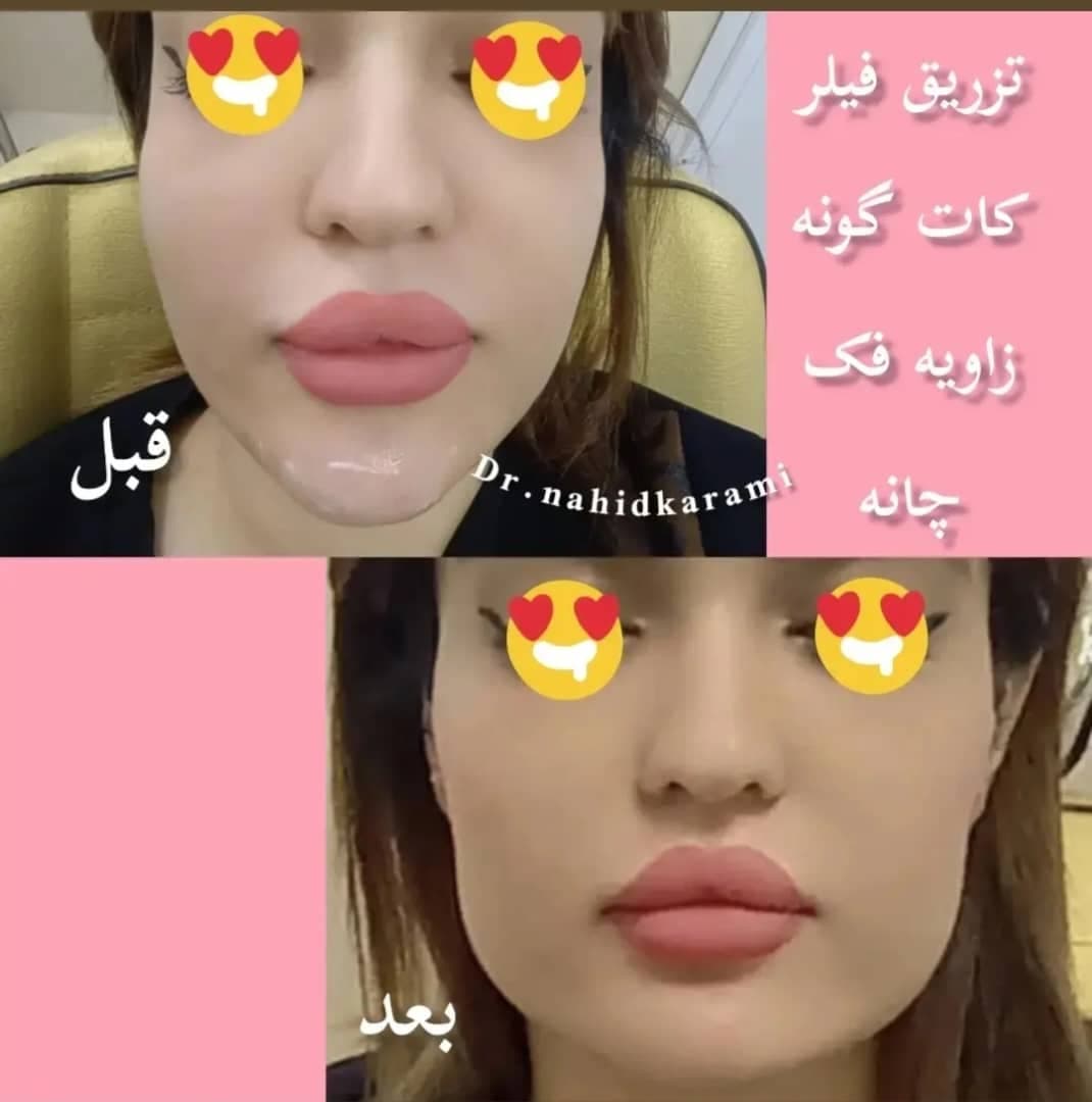 کلینیک زیبایی و لیزر لیلیا در برازجان بوشهر