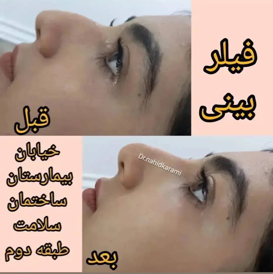 کلینیک زیبایی و لیزر لیلیا در برازجان بوشهر