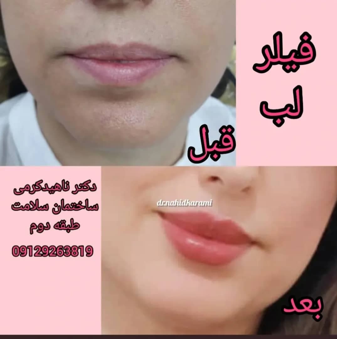 کلینیک زیبایی و لیزر لیلیا در برازجان بوشهر