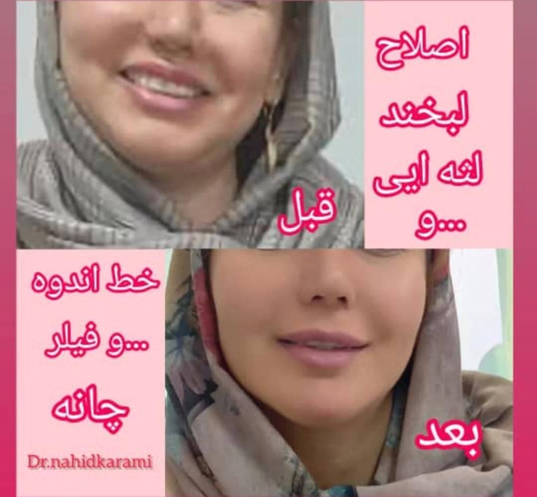 کلینیک زیبایی و لیزر لیلیا در برازجان بوشهر