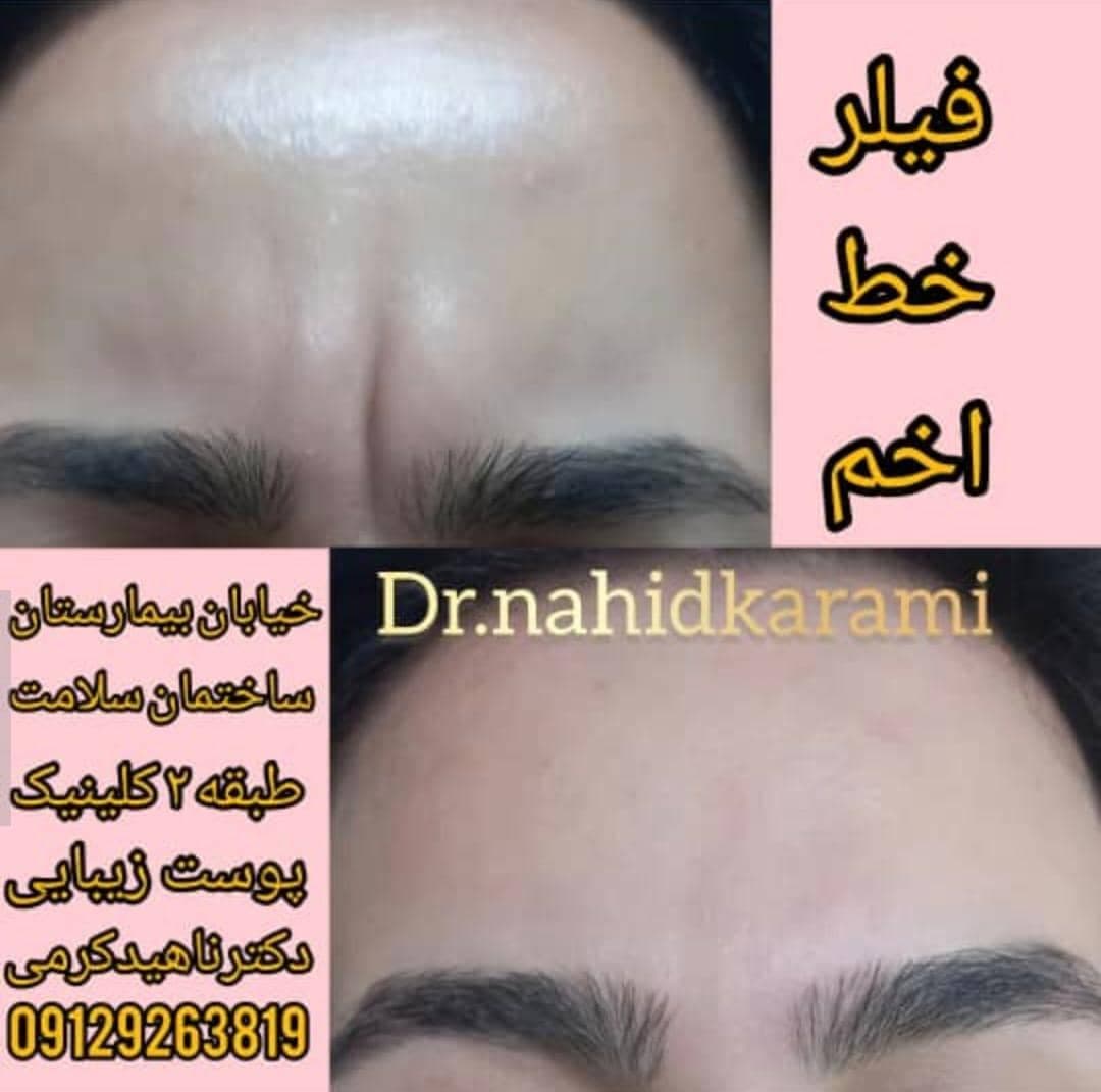 کلینیک زیبایی و لیزر لیلیا در برازجان بوشهر