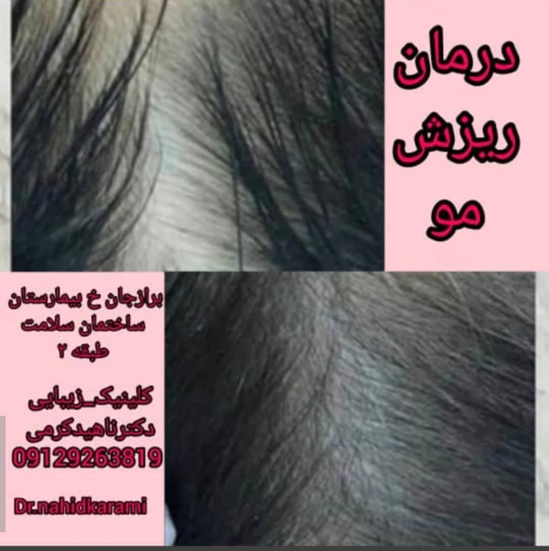 کلینیک زیبایی و لیزر لیلیا در برازجان بوشهر