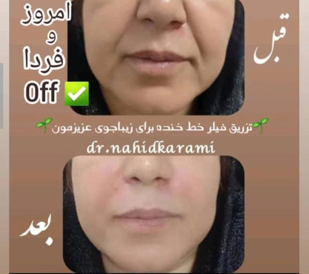 کلینیک زیبایی و لیزر لیلیا در برازجان بوشهر