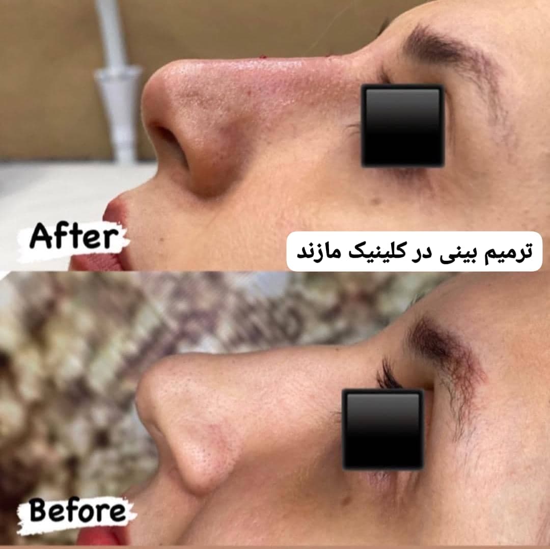 کلینیک زیبایی پوست و مو مازند در قائمشهر