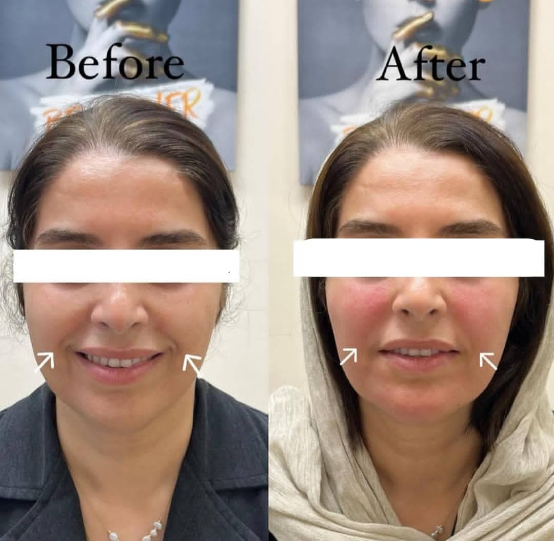 کلینیک زیبایی دانژه دکتر بهنام عمران در بابل