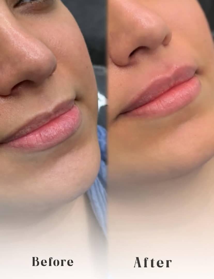 کلینیک زیبایی پوست و مو آوان در آمل