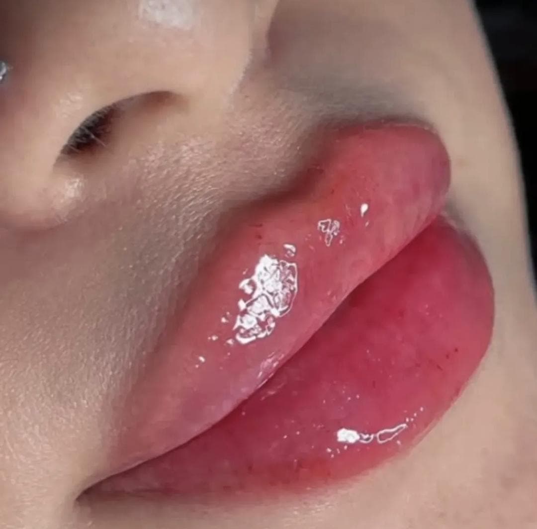 آموزش فیلر و بوتاکس آکادمی دکتر سهرابی در نوبهار کرمانشاه