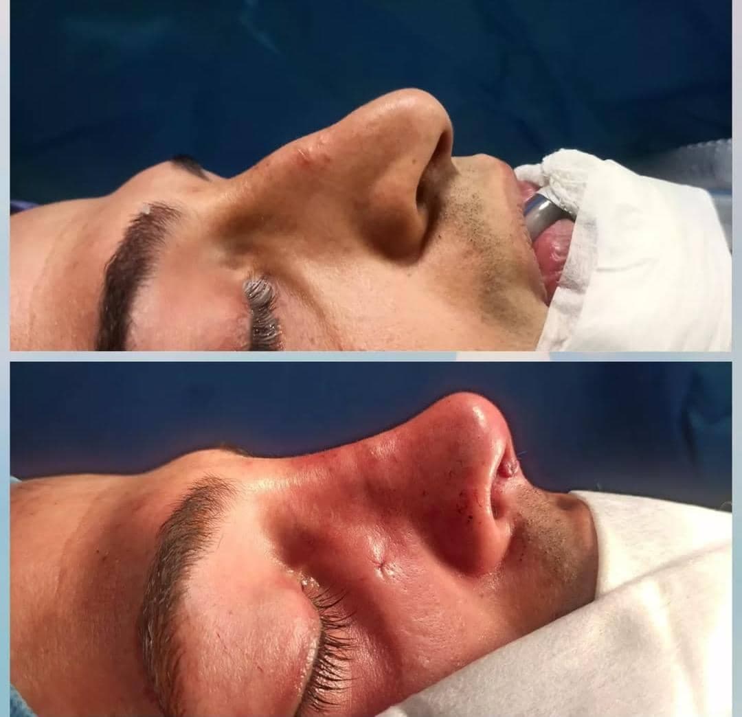 فوق تخصص جراحی پلاستیک زیبایی و ترمیمی دکتر عباس اکرمی در شیراز