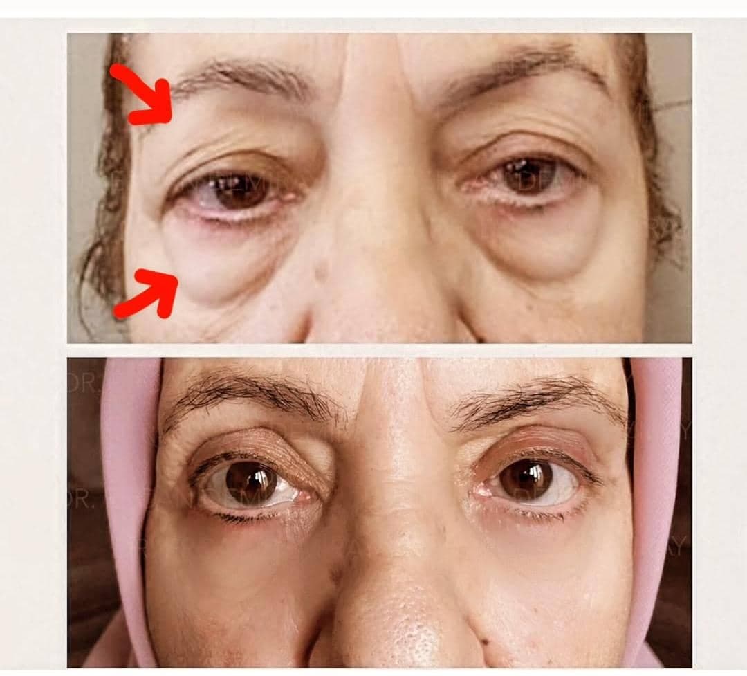 فوق تخصص جراحی پلاستیک زیبایی و ترمیمی دکتر عباس اکرمی در شیراز