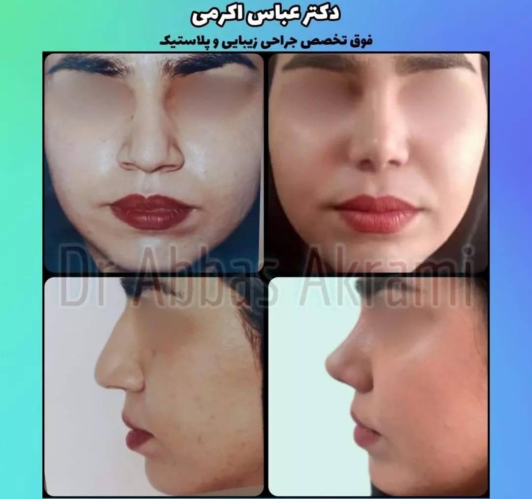 فوق تخصص جراحی پلاستیک زیبایی و ترمیمی دکتر عباس اکرمی در شیراز