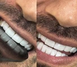 دندانپزشکی دکتر حمید حاج محمدی در چهارراه شهربابک سیرجان