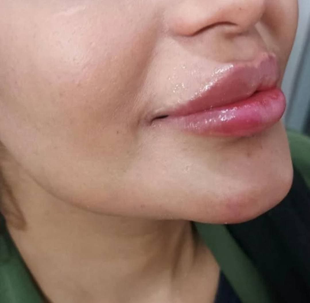 کلینیک زیبایی شانی مانی در خرم آباد