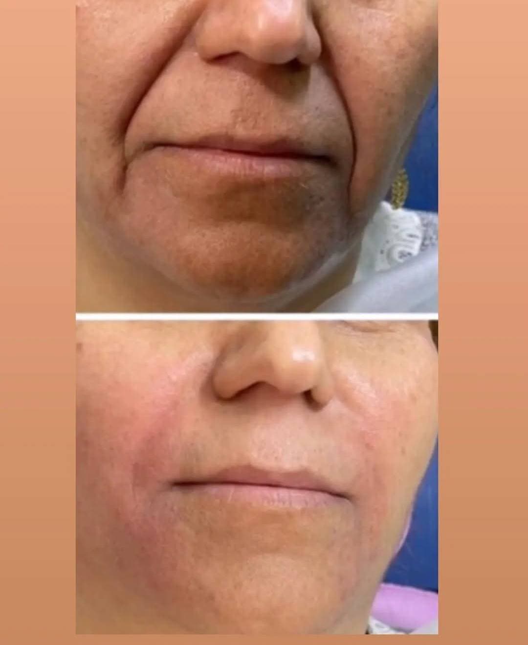 کلینیک زیبایی شانی مانی در خرم آباد