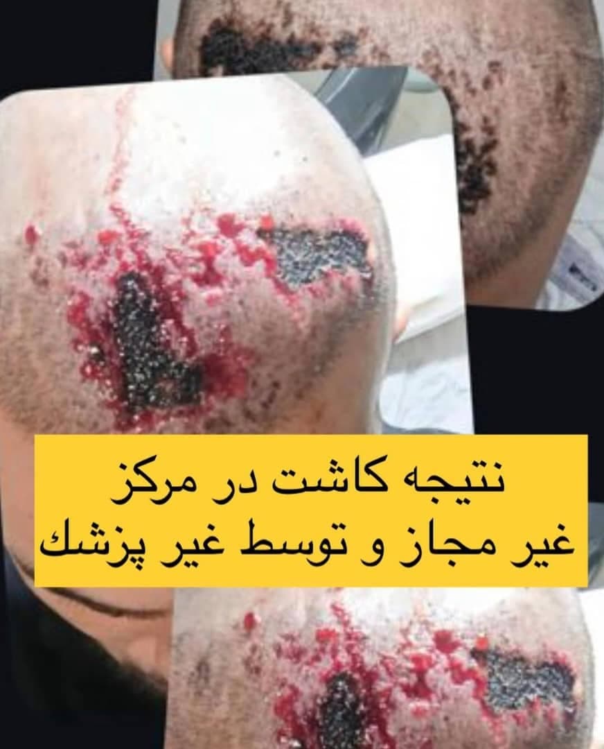 کلینیک تخصصی پوست و مو سینا در ولیعصر تبریز