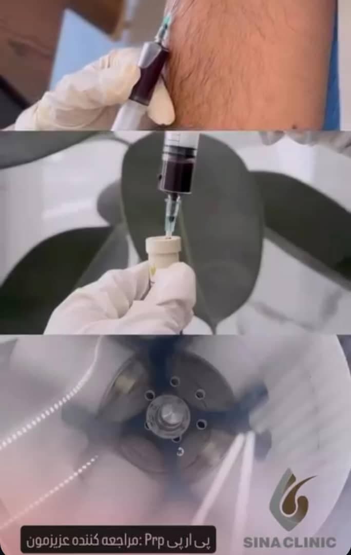 کلینیک تخصصی پوست و مو سینا در ولیعصر تبریز