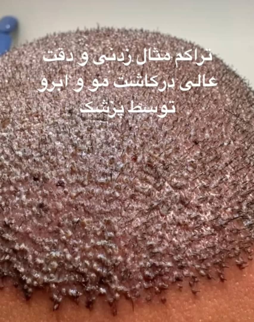 کلینیک تخصصی پوست و مو سینا در ولیعصر تبریز