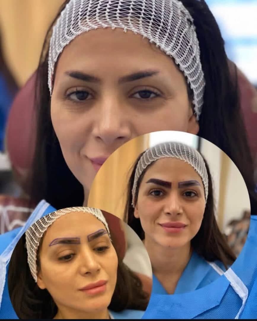 کلینیک تخصصی پوست و مو سینا در ولیعصر تبریز