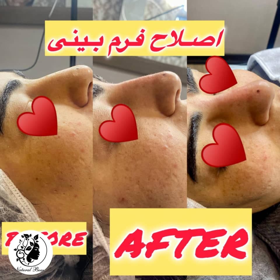 کلینیک زیبایی پوست و مو نچرال بیوتی دکتر رضاخانی در حکیم نظامی اصفهان