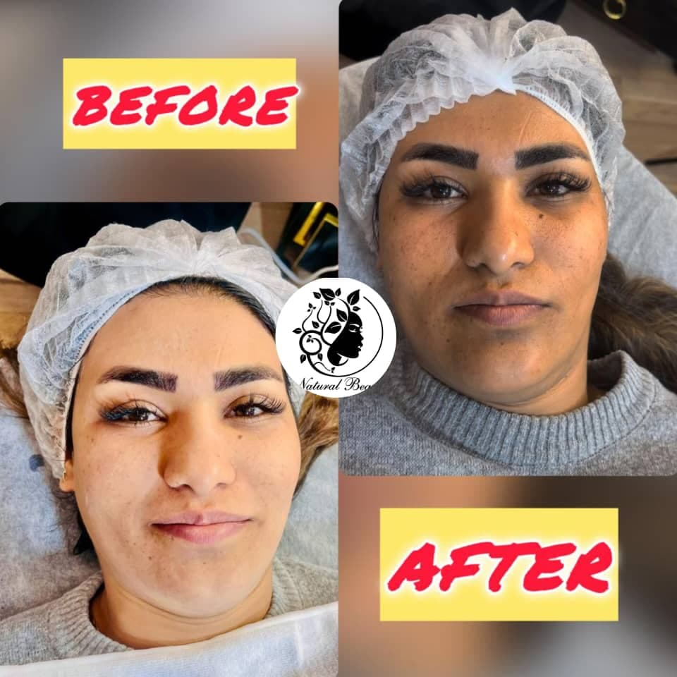 کلینیک زیبایی پوست و مو نچرال بیوتی دکتر رضاخانی در حکیم نظامی اصفهان