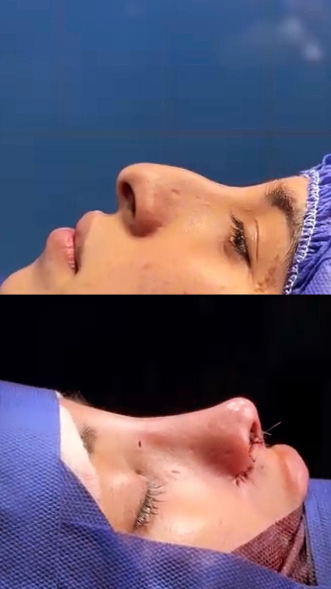 کلینیک زیبایی آنیل در مصطفی خمینی بندرعباس