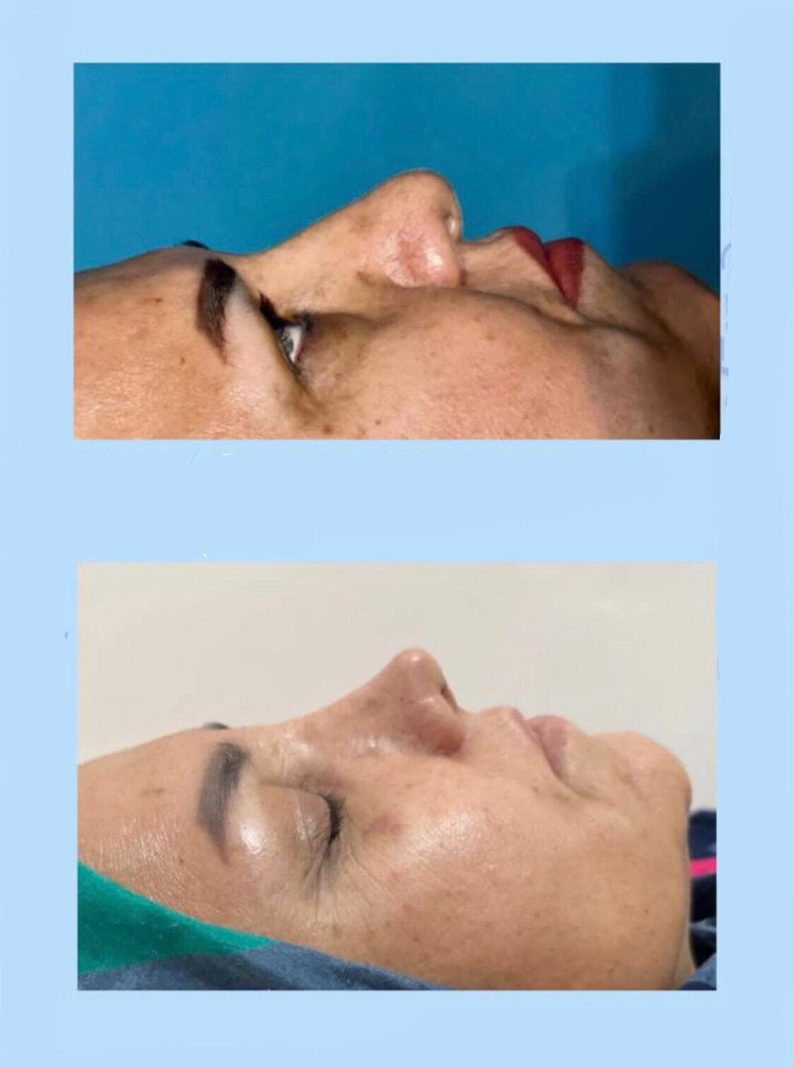 کلینیک زیبایی آنیل در مصطفی خمینی بندرعباس