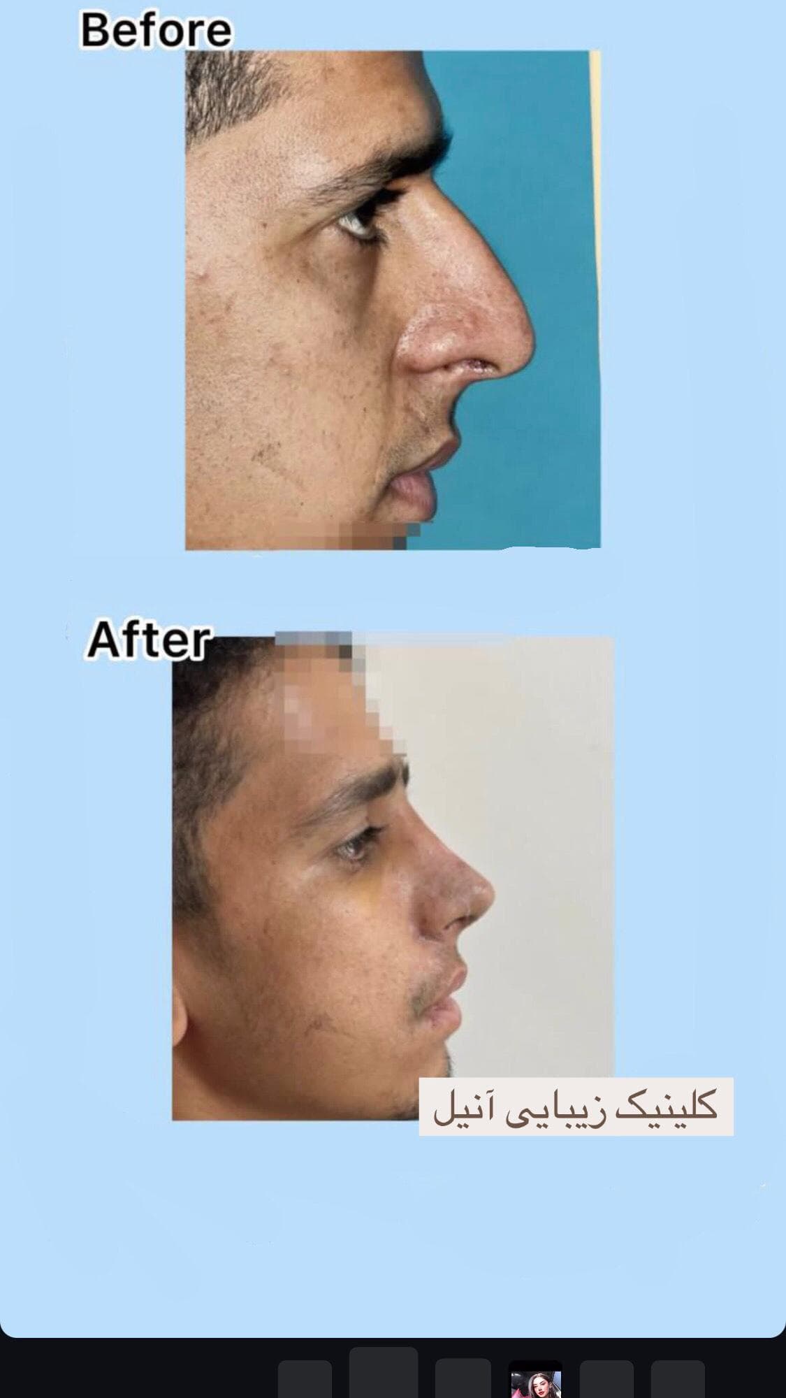 کلینیک زیبایی آنیل در مصطفی خمینی بندرعباس