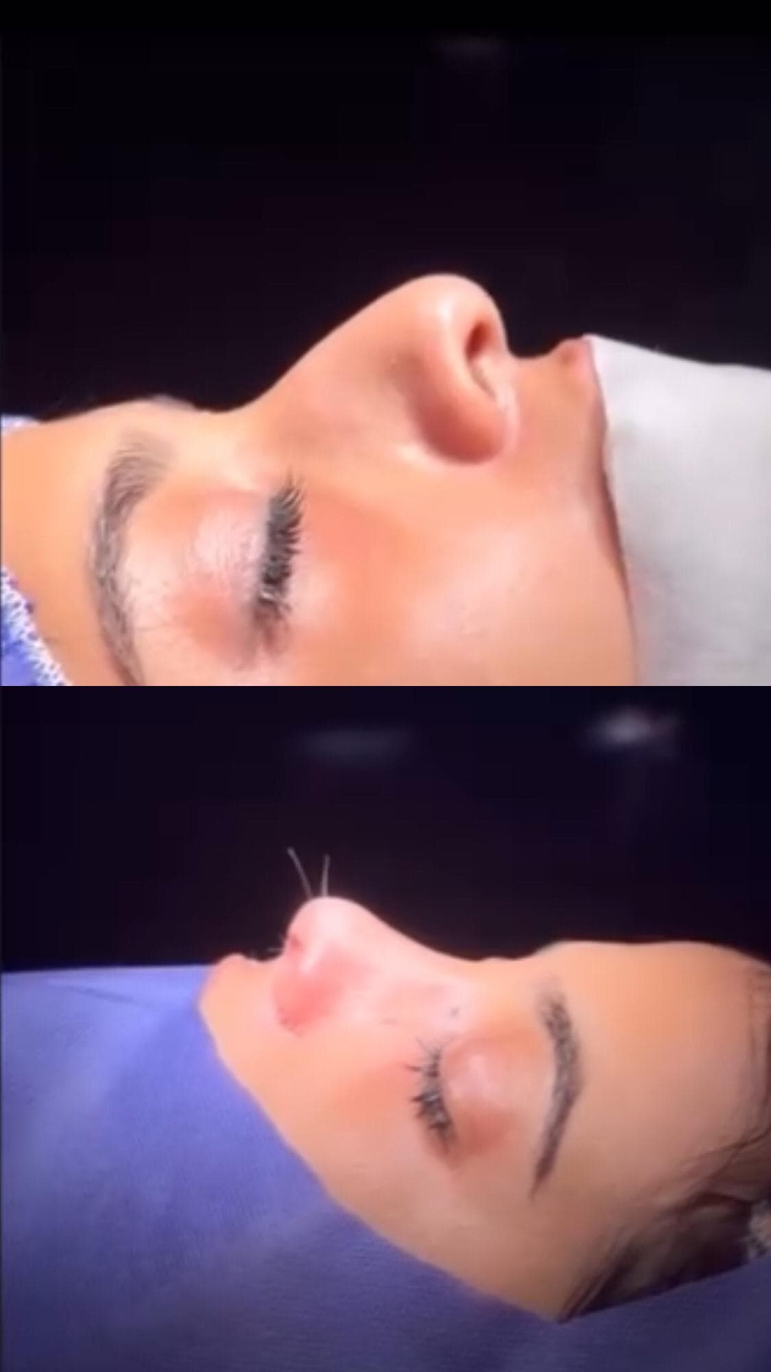 کلینیک زیبایی آنیل در مصطفی خمینی بندرعباس