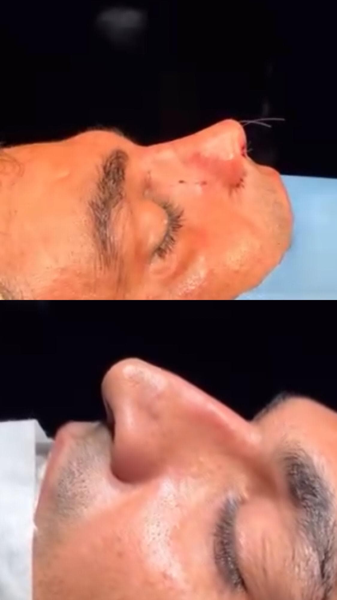 کلینیک زیبایی آنیل در مصطفی خمینی بندرعباس