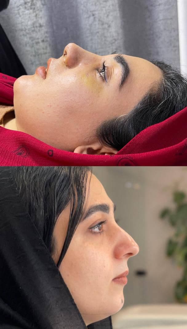 کلینیک زیبایی آنیل در مصطفی خمینی بندرعباس