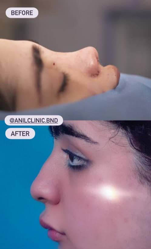 مرکز ویژه فیلر بادی آنیل در بندرعباس