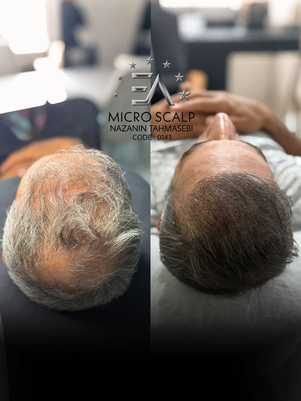 مرکز تخصصی اسکالپ کف سر نازنین طهماسبی در نجف آباد