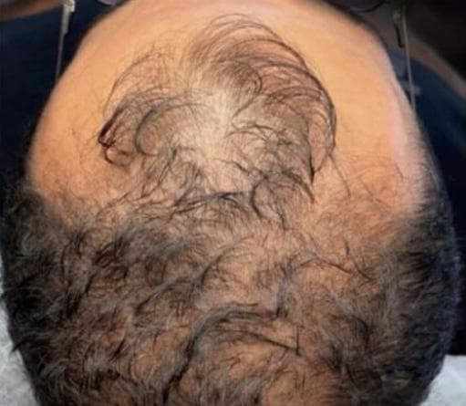 مرکز تخصصی اسکالپ کف سر نازنین طهماسبی در نجف آباد