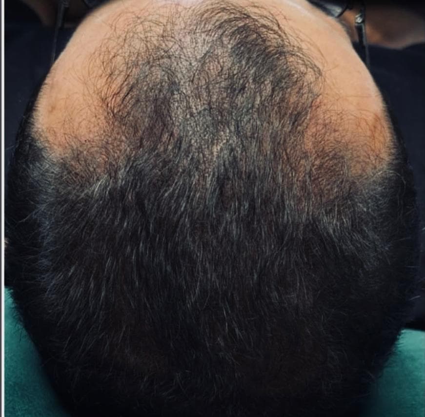 مرکز تخصصی اسکالپ کف سر نازنین طهماسبی در نجف آباد