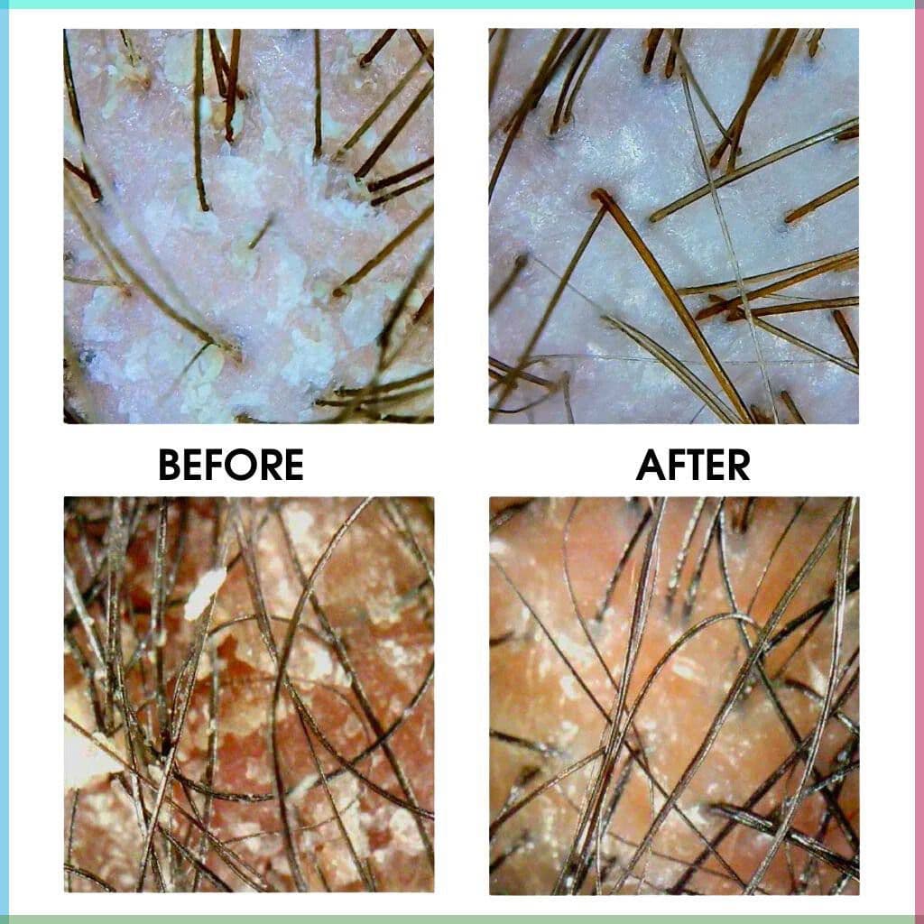 مرکز تخصصی اسکراپ اسکالپ سولماز نعلی در بابلسر