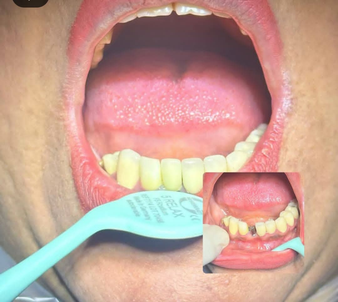 دندانپزشکی تخصصی دکتر حسین جبالی در یزد