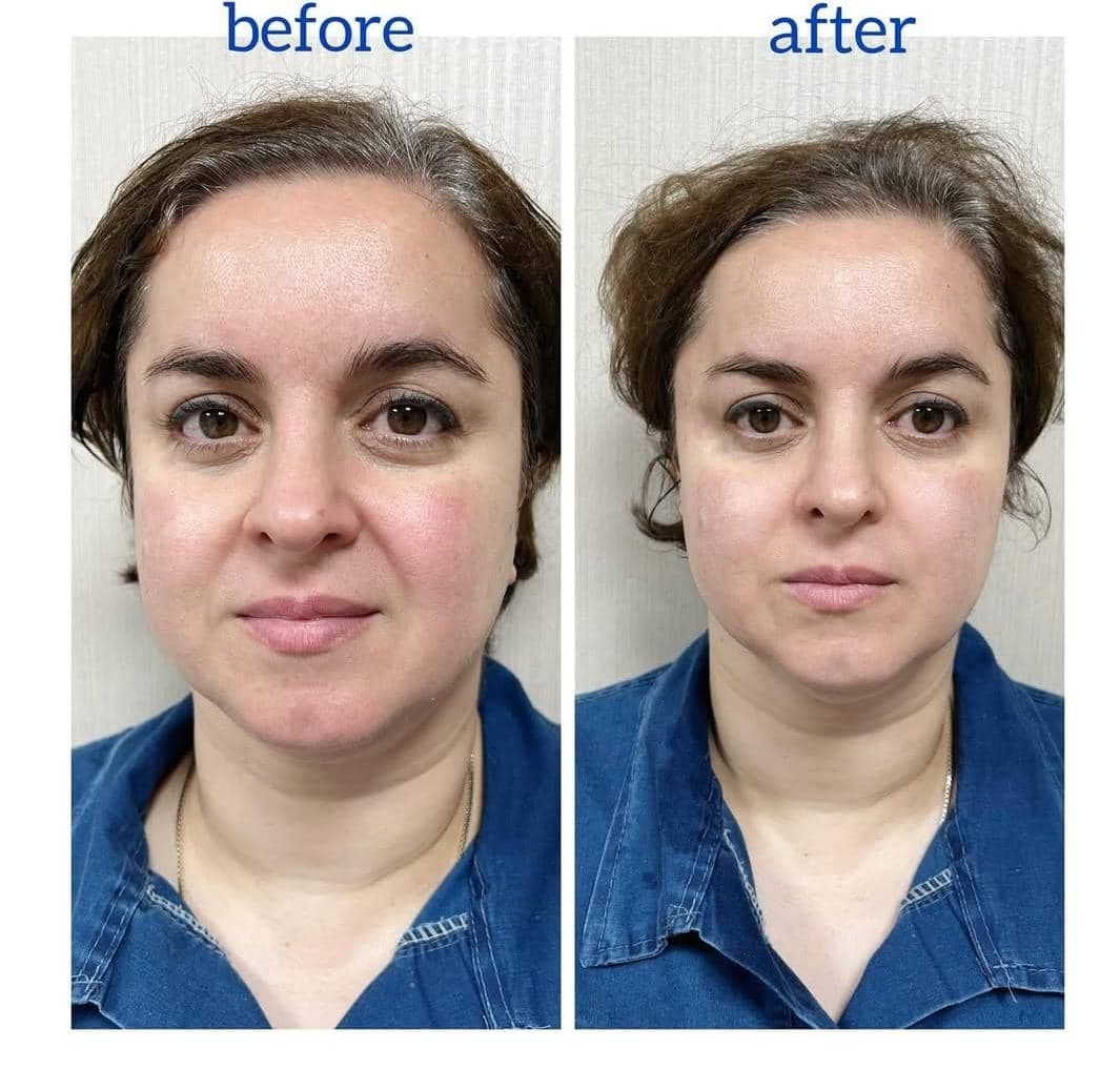 کلینیک لیزر و زیبایی الهام رشت