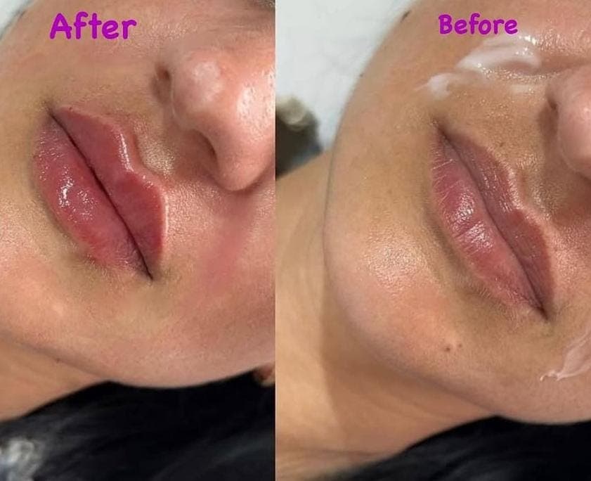 آموزش و درمان جوش و اسکار مرضیه سجادیان در کرمانشاه