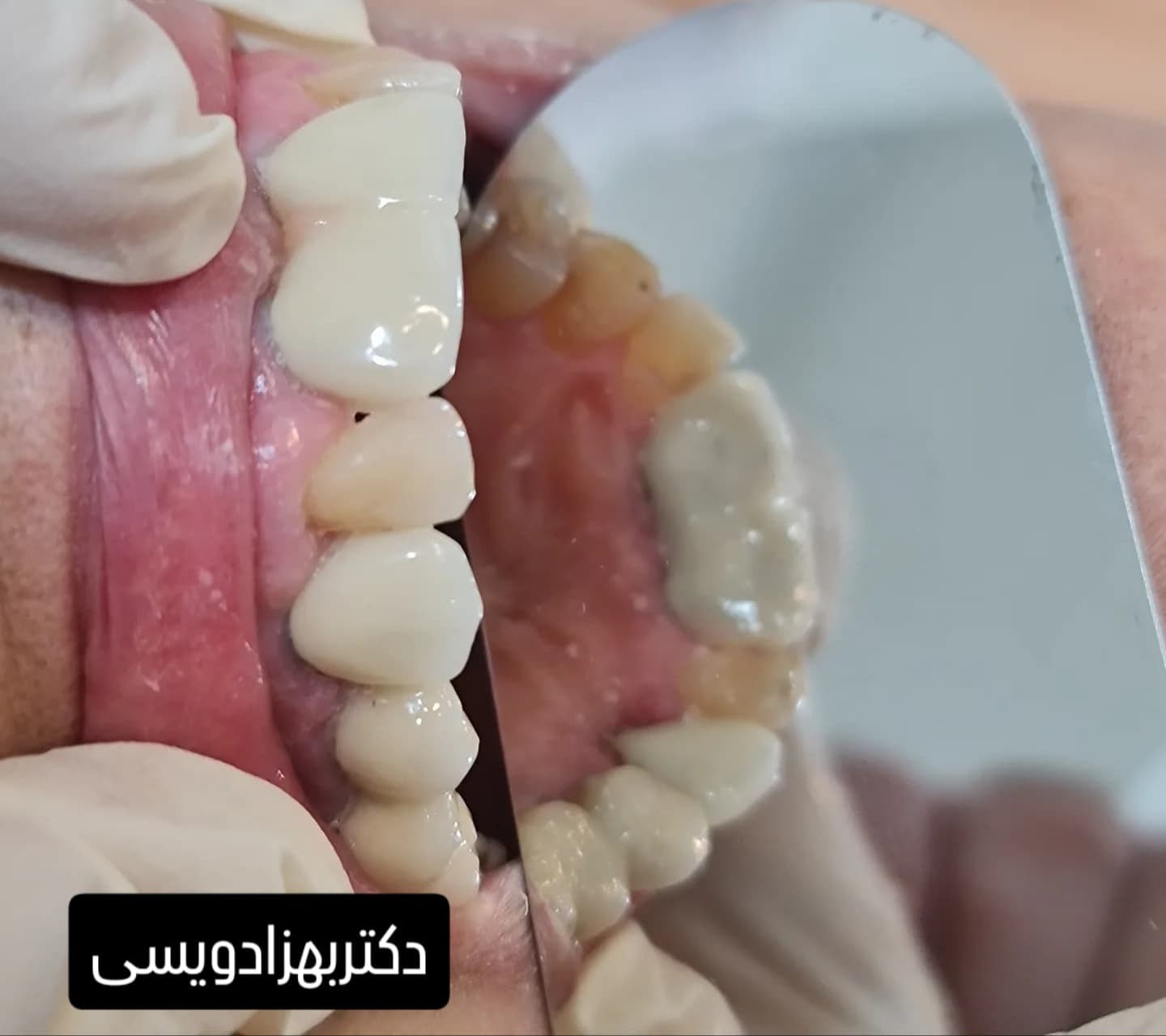 مرکز دندانپزشکی تخصصی دکتر بهزاد ویسی در سنندج