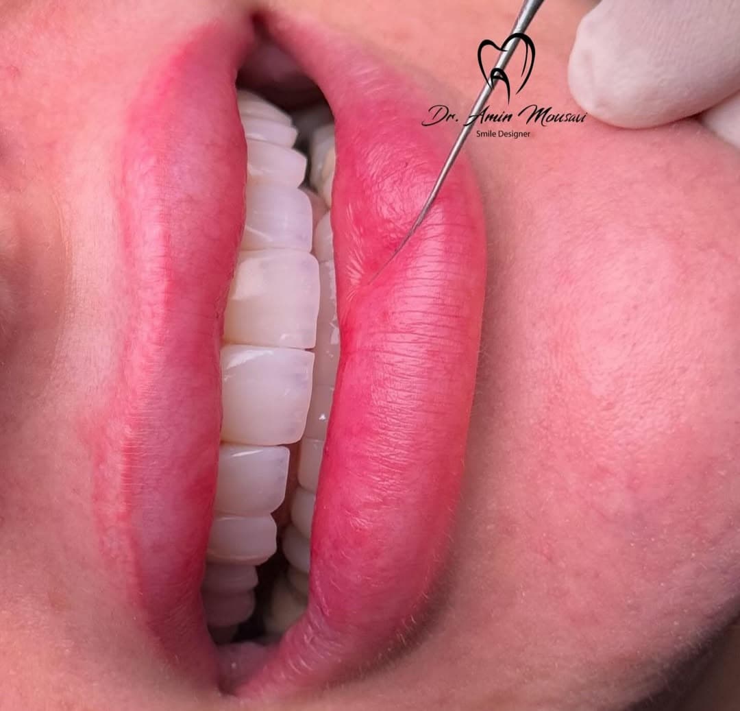 مطب دندانپزشکی و کامپوزیت تخصصی دکتر امین موسوی در اهواز