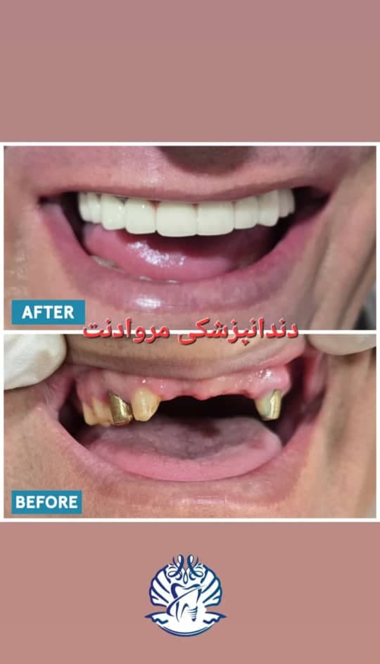 دندانپزشکی مروادنت به مدیریت دکتر بردبار و خان احمدی در کیانشهر تهران